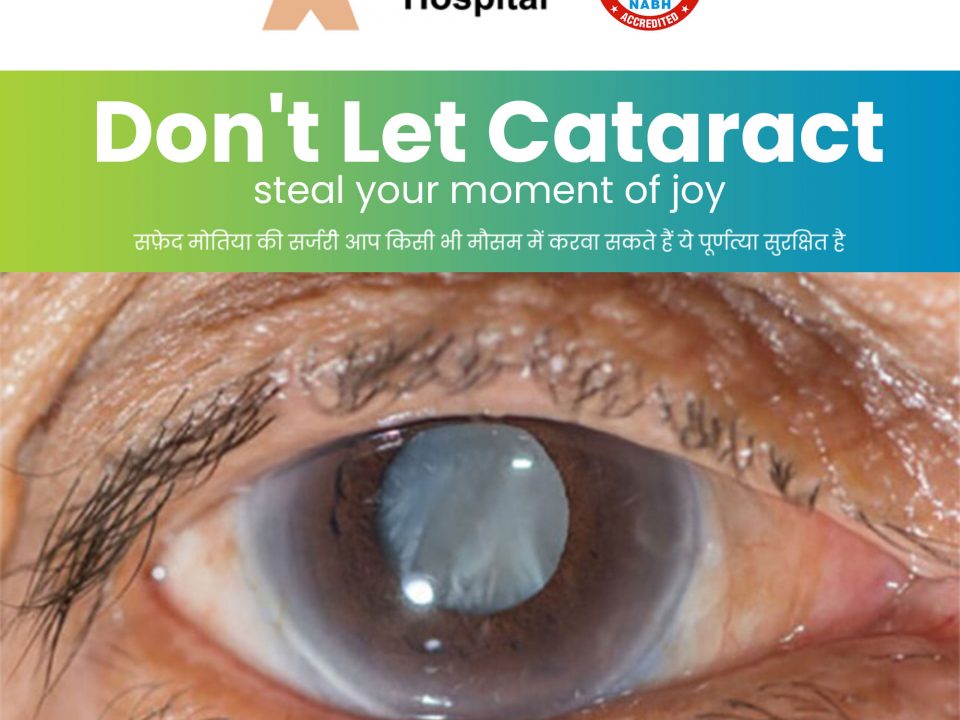 Cataract Surgery in Panipat | Safed Motiya ka operation Panipat me | Gupta Eye Hospital Panipat